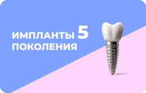 Что выбрать мост или имплант