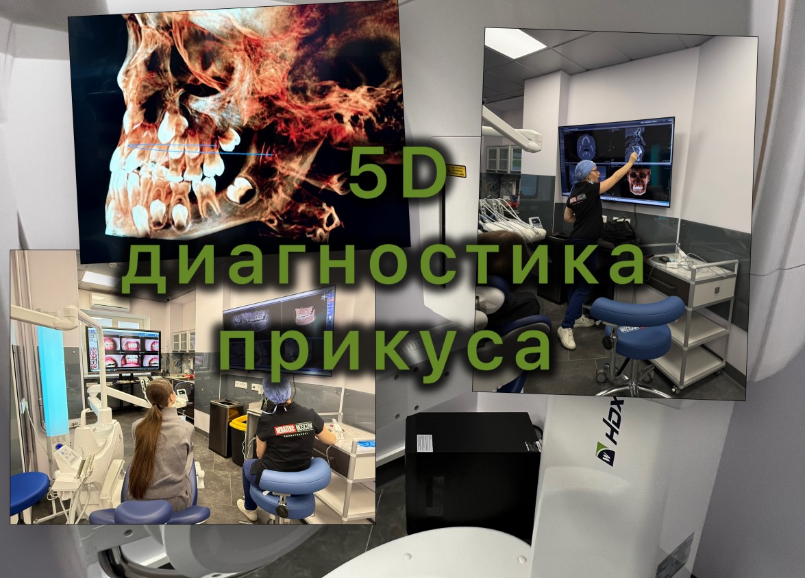 Красивая улыбка после лечения