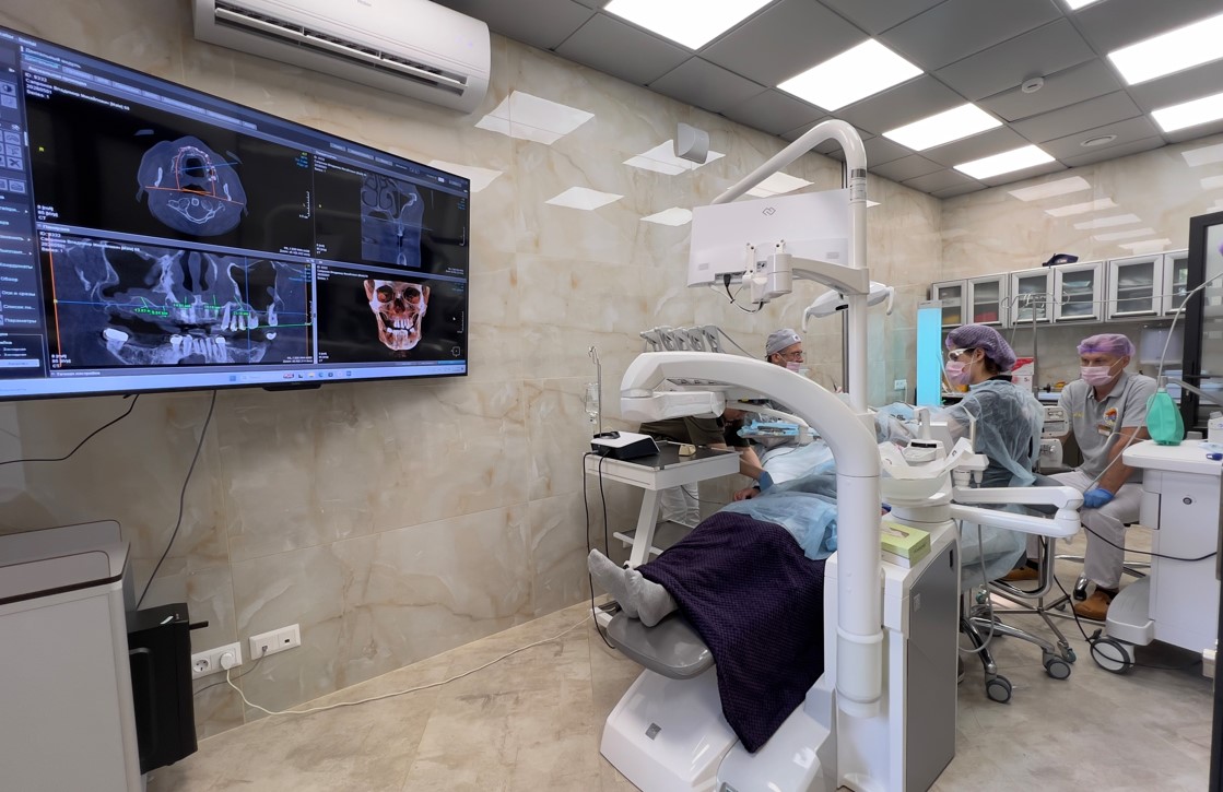 Костная пластика перед имплантацией зубов