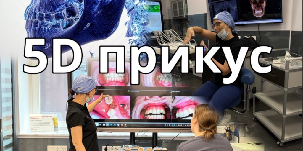 Лингвальные брекеты