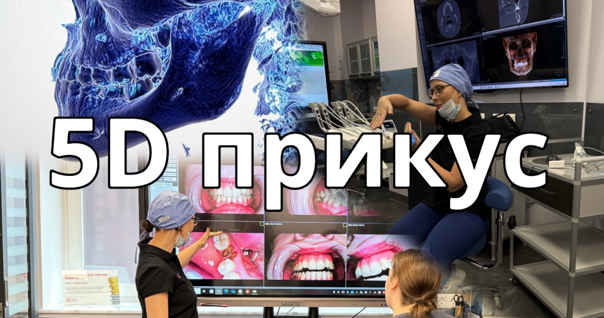Лингвальные брекеты