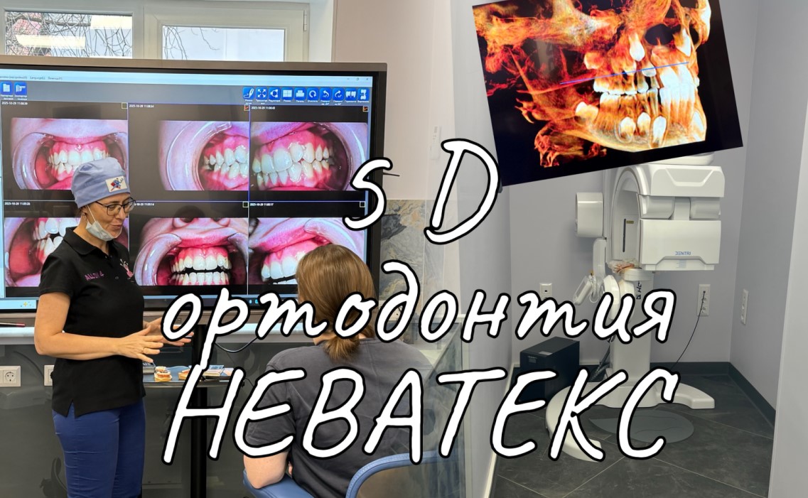 Лингвальные брекеты