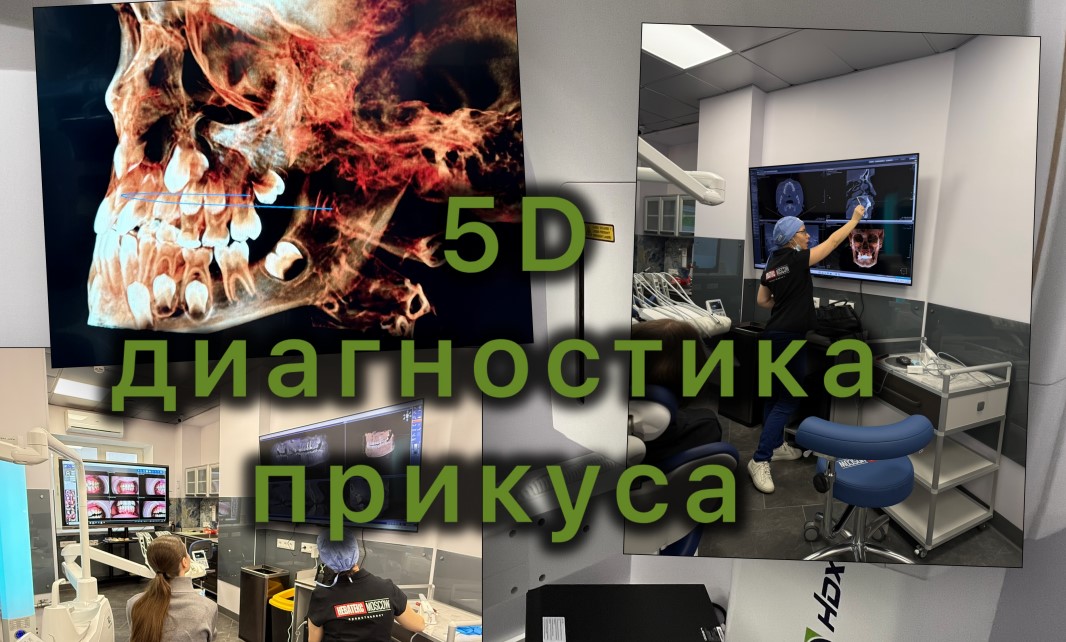 Лингвальные брекеты