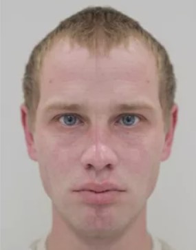 Лечение остеомиелит после